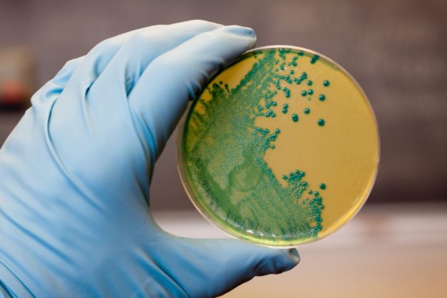 https://www.foodbusinessnews.net/ext/resources/2024/12/31/bacteria.jpg?height=418&t=1735735424&width=800